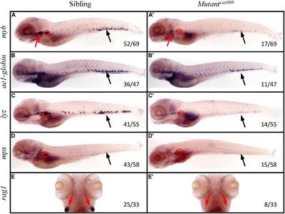 Mutation of Gemin5 Causes Defective Hematopoietic Stem/Progenitor Cells Proliferation in Zebrafish Embryonic Hematopoiesis